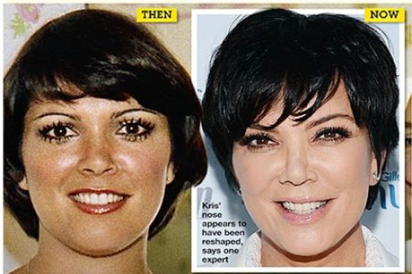 Perubahan wajah Kris Jenner
