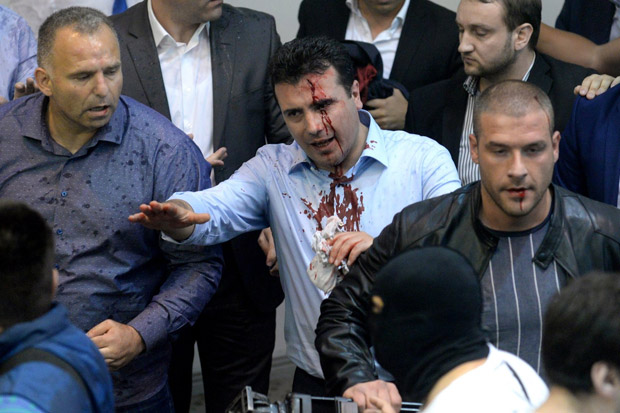 Pemimpin oposisi, Zoran Zaev (tengah), berdarah setelah diserang.