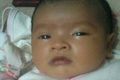 Bayi-bayi malang penderita gizi buruk di Jakarta
