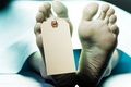 Polisi autopsi potongan tubuh korban mutilasi