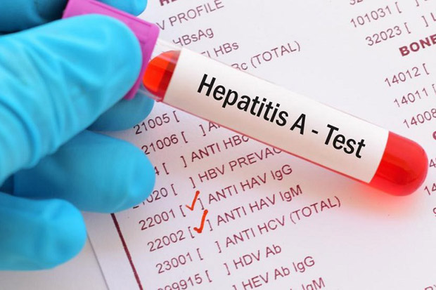 Puluhan Siswa Diserang Hepatitis A, Dinkes Depok Nyatakan KLB Parsial